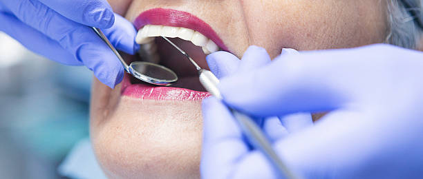 Best Emergency Dental Care for Broken or Chipped Teeth in Miami Beach, FL